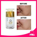 KB Dermafirm Vitamin Peeling Gel 15ml